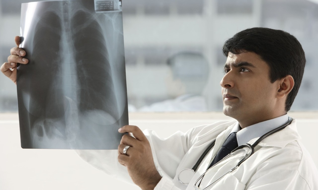 Pulmón EPOC AstraZeneca