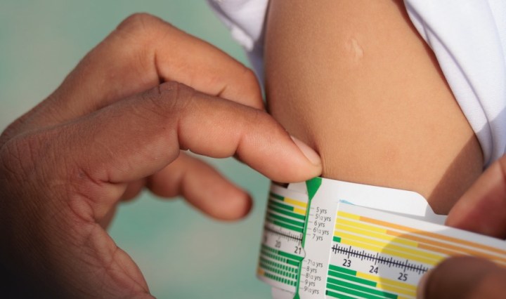 MUAC zscore medición