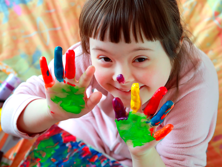 Síndrome de Down CONDICIÓN