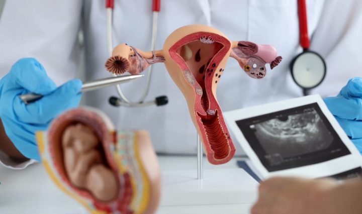 el pilar cancer ovario