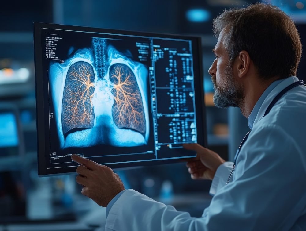 AstraZeneca Early Detection of Lung Cancer - Doctor Examining X-ray with Visible Tumor for Diagnosis | Realistic Medical Photography with Lung Health Focus
