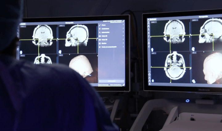 Claves para mantener un cerebro sano