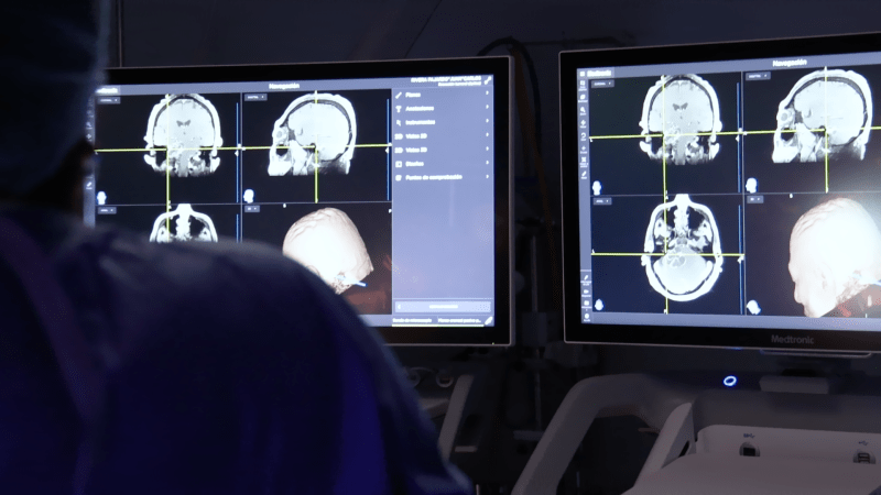 Claves para mantener un cerebro sano