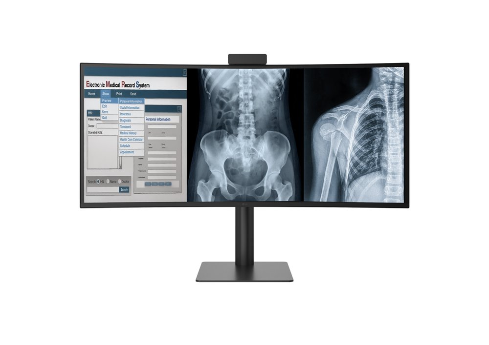 Lg electronics presenta su monitor de diagnóstico ultrawide curvo de 40 pulgadas con autorización de la fda