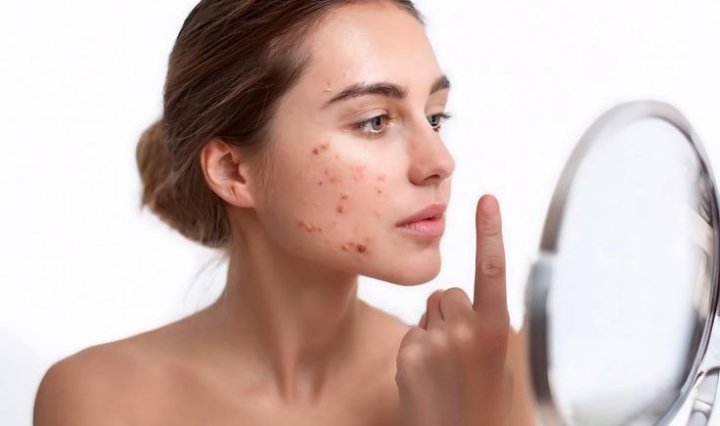 Reducir y prevenir las imperfecciones empieza por entender cómo funciona la piel
